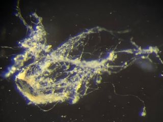 thumbnail - Bactérie Électrique