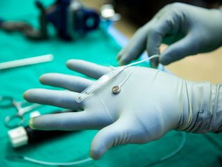 thumbnail - Technologie d'Implant
