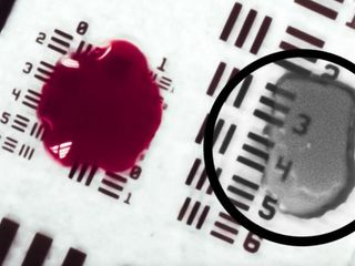 thumbnail - IA Chirurgie